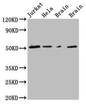 TUBG1 Antibody