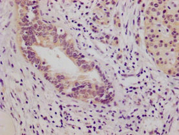 NFE2L2 Antibody