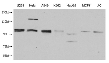 MBTPS1 Antibody