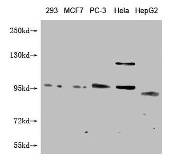 FILIP1L Antibody