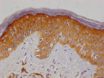 MERTNL Antibody