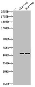 His Antibody