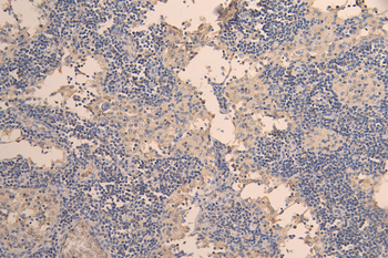 IL12&IL23 Antibody