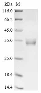 Recombinant Human Neuropeptide B (NPB)