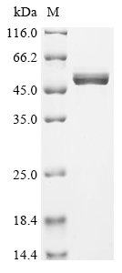 Recombinant Human Calreticulin (CALR)