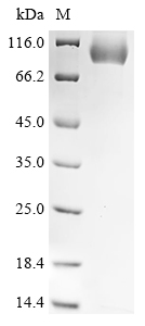 Recombinant Mouse Serine protease inhibitor A3K (Serpina3k)