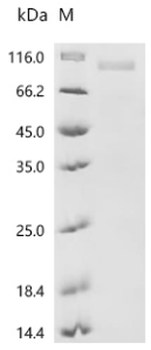 Recombinant Human Polypyrimidine tract-binding protein 1 (PTBP1)