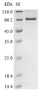 Recombinant AKV murine leukemia virus Envelope glycoprotein (env), partial