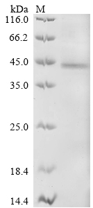 Recombinant Human Receptor-type tyrosine-protein kinase FLT3 (FLT3), partial