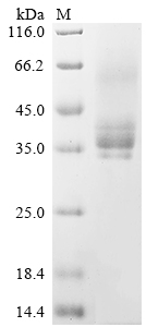 Recombinant Human Methyl-CpG-binding domain protein 2 (MBD2), partial