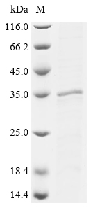 Recombinant Saccharomyces cerevisiae Heat shock protein 60,mitochondrial (HSP60), partial
