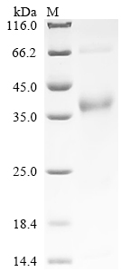 Recombinant Macaca mulatta Neurofilament light polypeptide(NEFL),partial