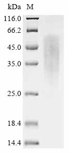 Recombinant Human RAD51-associated protein 1 (RAD51AP1)