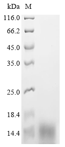 Recombinant Rat Vesicular glutamate transporter 1 (Slc17a7), partial