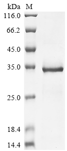 Recombinant Chicken Glycine cleavage system H protein, mitochondrial (GCSH)
