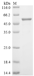 Recombinant Human Calreticulin (CALR)