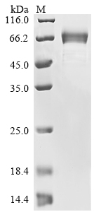 Recombinant Human Novel Coronavirus Spike glycoprotein (S), partial