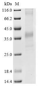 Recombinant Human Delta-type opioid receptor (OPRD1)