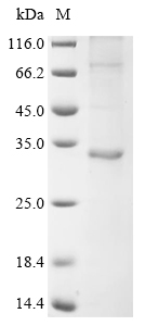 Recombinant Human papillomavirus type 16 Probable protein E5 (E5)