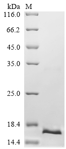 Recombinant Human DNA-directed RNA polymerase III subunit RPC10 (POLR3K)