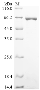 Recombinant Human ATP-dependent RNA helicase DDX19B (DDX19B)