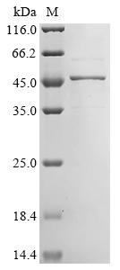Recombinant Human Hypoxia-inducible factor 1-alpha inhibitor (HIF1AN)