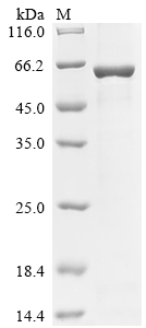 Recombinant Human E3 ubiquitin-protein ligase TRIM7 (TRIM7)