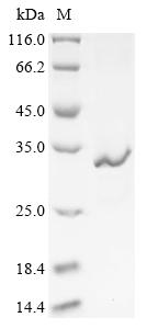 Recombinant Clostridium tetani Tetanus toxin, partial