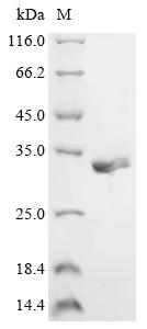 Recombinant Adeno-associated virus 2 Protein Rep78 (Rep78), partial