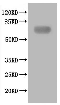 Recombinant Coxiella burnetii Uncharacterized protein (CBU_2007)