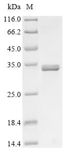 Recombinant Human Choline transporter-like protein 4 (SLC44A4), partial