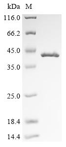 Recombinant Bovine Malate dehydrogenase, cytoplasmic (MDH1),Escherichia Coli