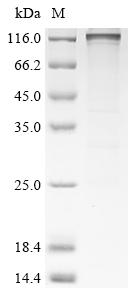 Recombinant Human Disks large-associated protein 5 (DLGAP5)