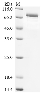 Recombinant Human TNFAIP3-interacting protein 1 (TNIP1)