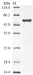 Recombinant Mycobacterium tuberculosis Steroid C26-monooxygenase (cyp125)