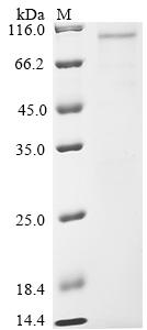 Recombinant Mycobacterium tuberculosis Serine/threonine-protein kinase pknF (pknF)