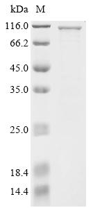 Recombinant Human Gasdermin-D (GSDMD), Biotinylated