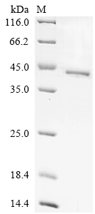 Recombinant Human Protein Wnt-4 (WNT4)