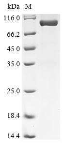 Recombinant Human Dual specificity mitogen-activated protein kinase kinase 3 (MAP2K3), Biotinylated