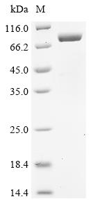 Recombinant Human adenovirus F serotype 41 Hexon protein (L3), partial, Biotinylated