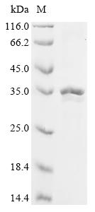 Recombinant Human Fibroblast growth factor 3 (FGF3)