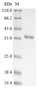 Recombinant Brucella melitensis biotype 1 31 kDa immunogenic protein (bcsP31)