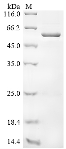 Recombinant Newcastle disease virus Nucleoprotein (N)