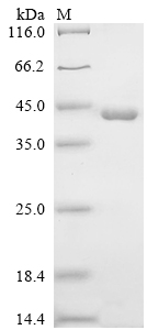 Recombinant Human Glucocorticoid receptor (NR3C1), partial