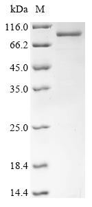 Recombinant Moloney murine leukemia virus Gag-Pol polyprotein (gag-pol), partial