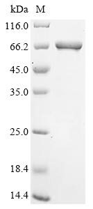 Recombinant Epstein-Barr virus Epstein-Barr nuclear antigen 1 (EBNA1), partial, Biotinylated