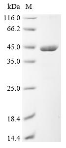 Recombinant Epstein-Barr virus Triplex capsid protein 1 (TRX1)