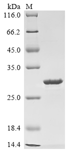 Recombinant Mouse Putative hydrolase RBBP9 (Rbbp9)