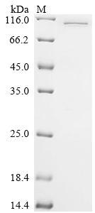 Recombinant Human DNA polymerase theta (POLQ), partial