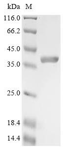 Recombinant Aquifex aeolicus Reverse gyrase 2 (rgy2), partial